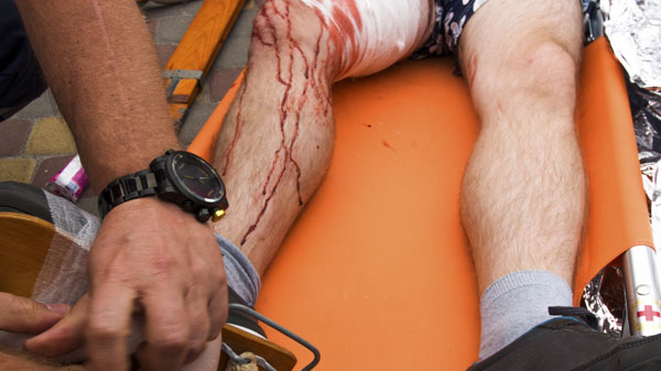 Un uomo con una ferita alla gamba, immagine di repertorio
